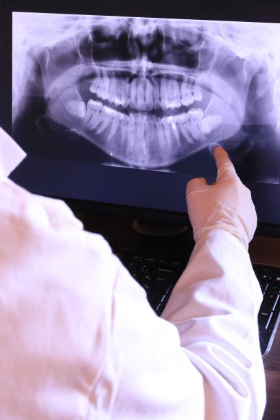 Best Emergency Wisdom Tooth Extraction in Glendale Heights, IL